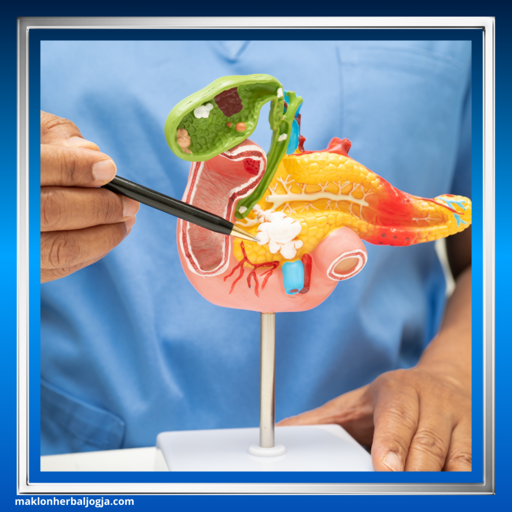 Herbal Mencegah Gangguan Empedu