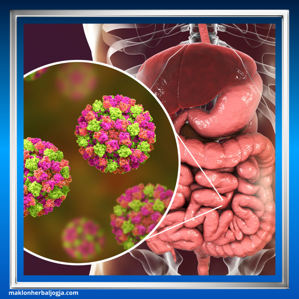 Herbal Mengatasi Infeksi Usus 