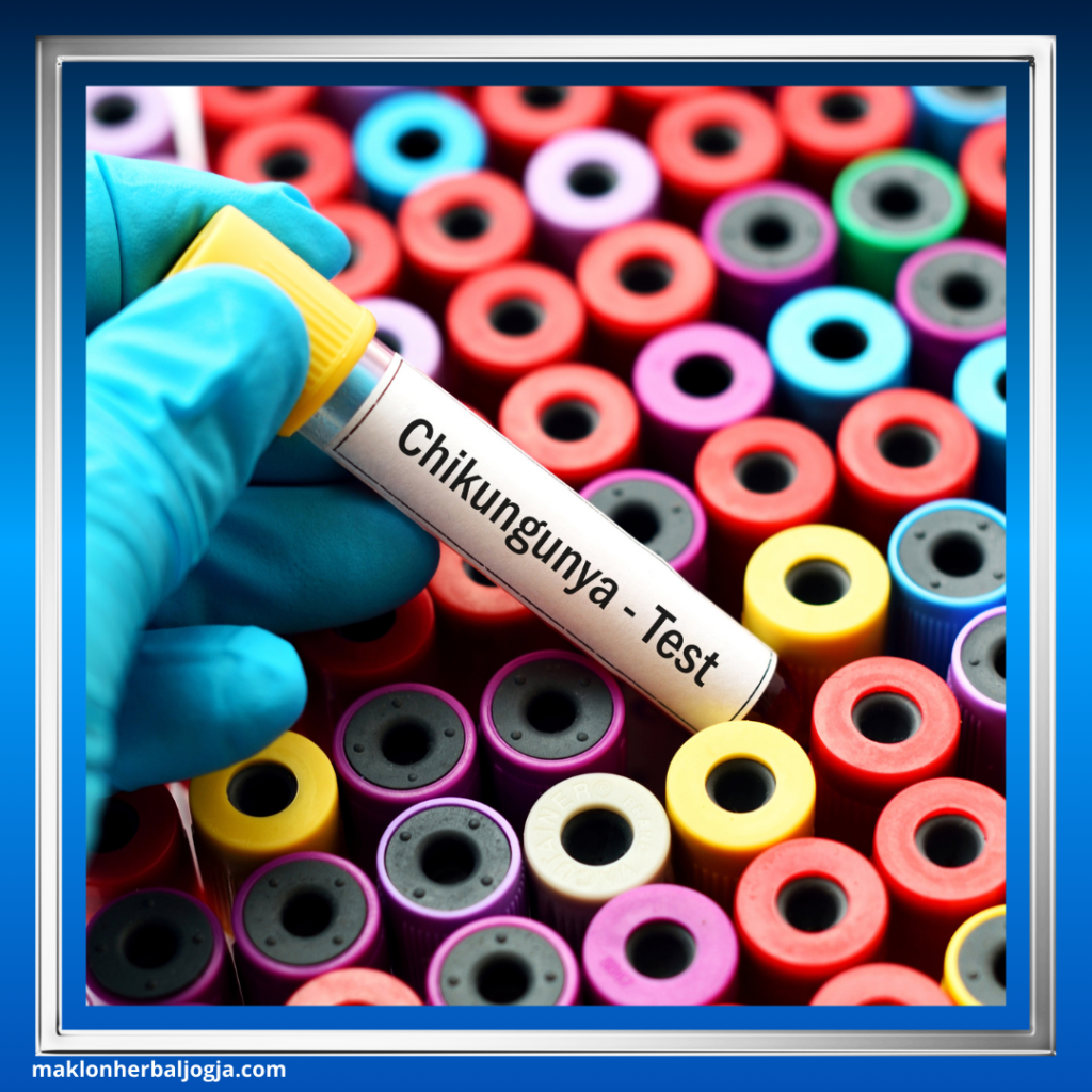 Gejala Chikungunya