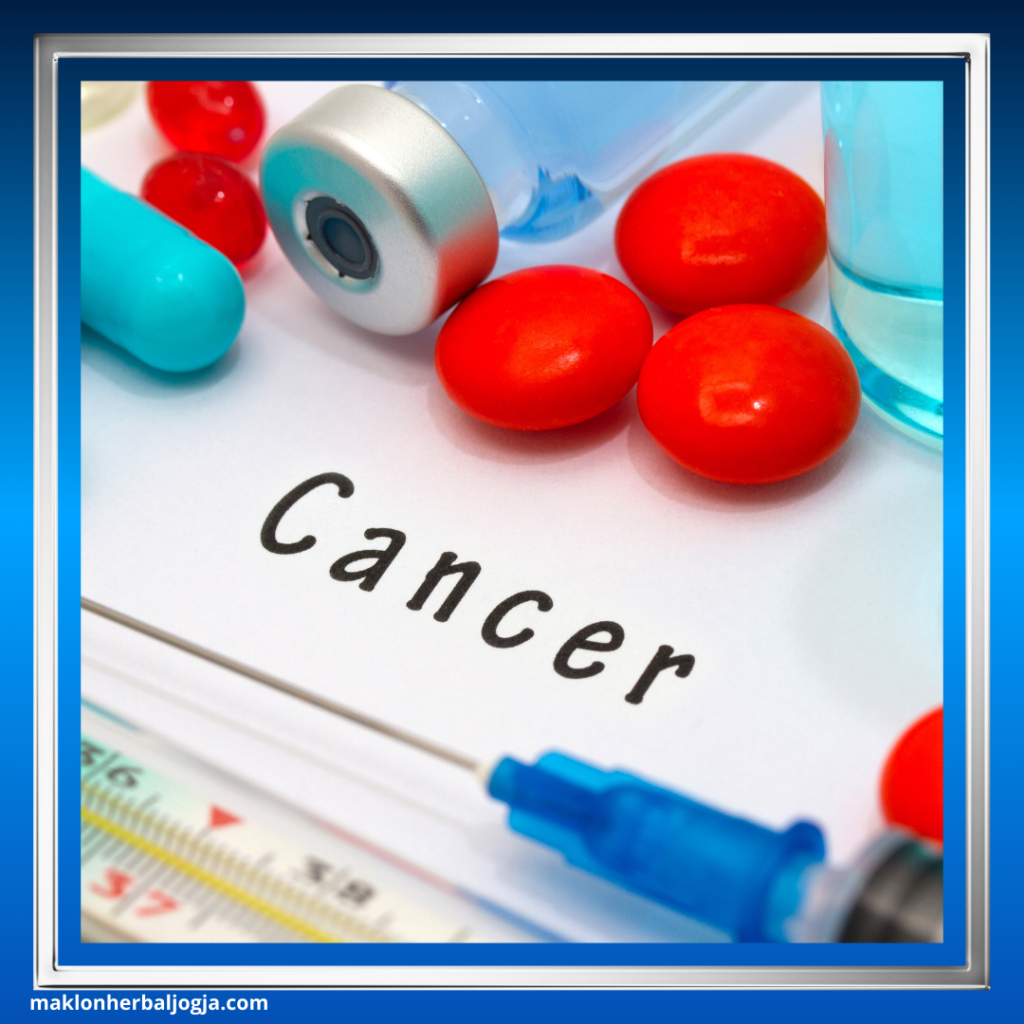 Jenis-Jenis Kanker 