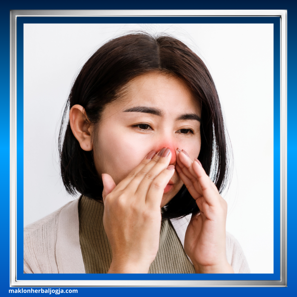 Cara Mengatasi Hidung Tersumbat