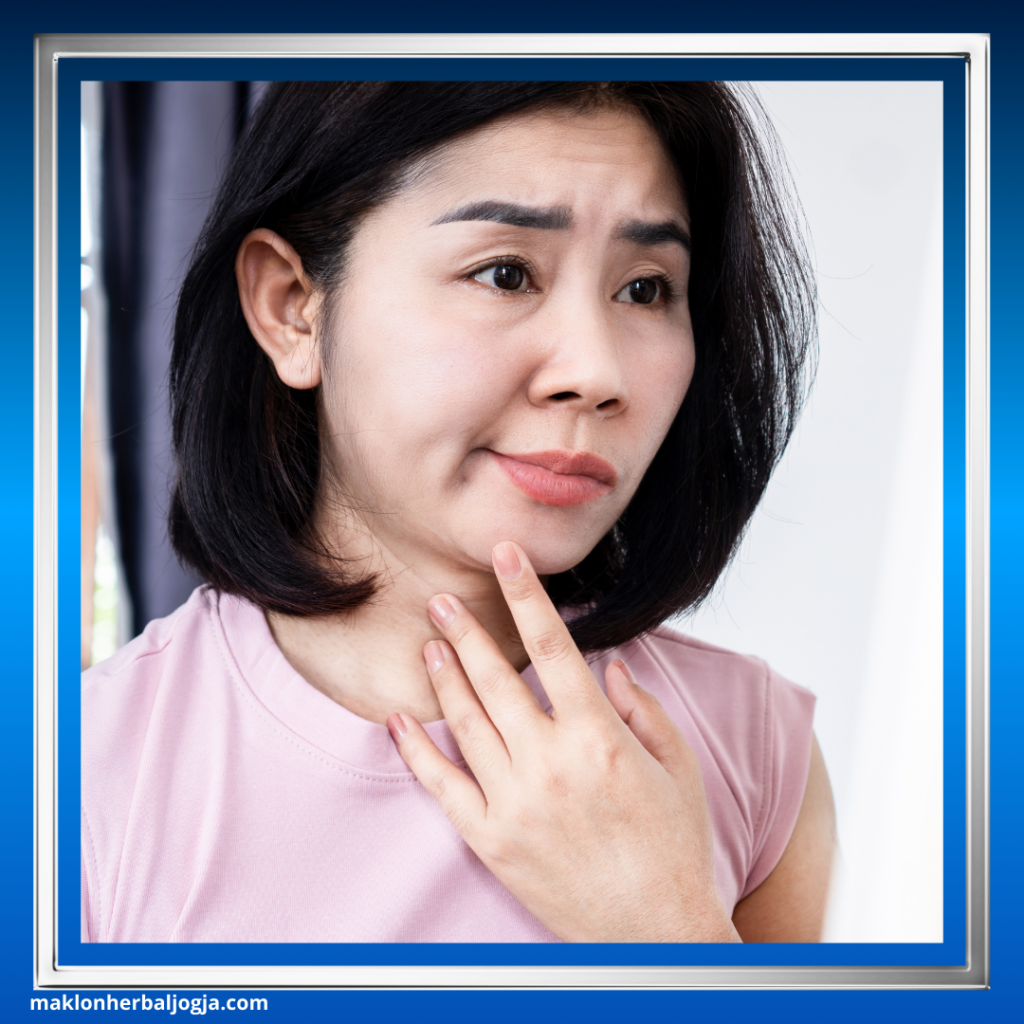 Mengenal Bell's Palsy