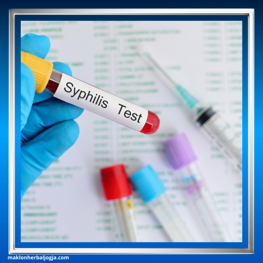 Sifilis pada Ibu Hamil