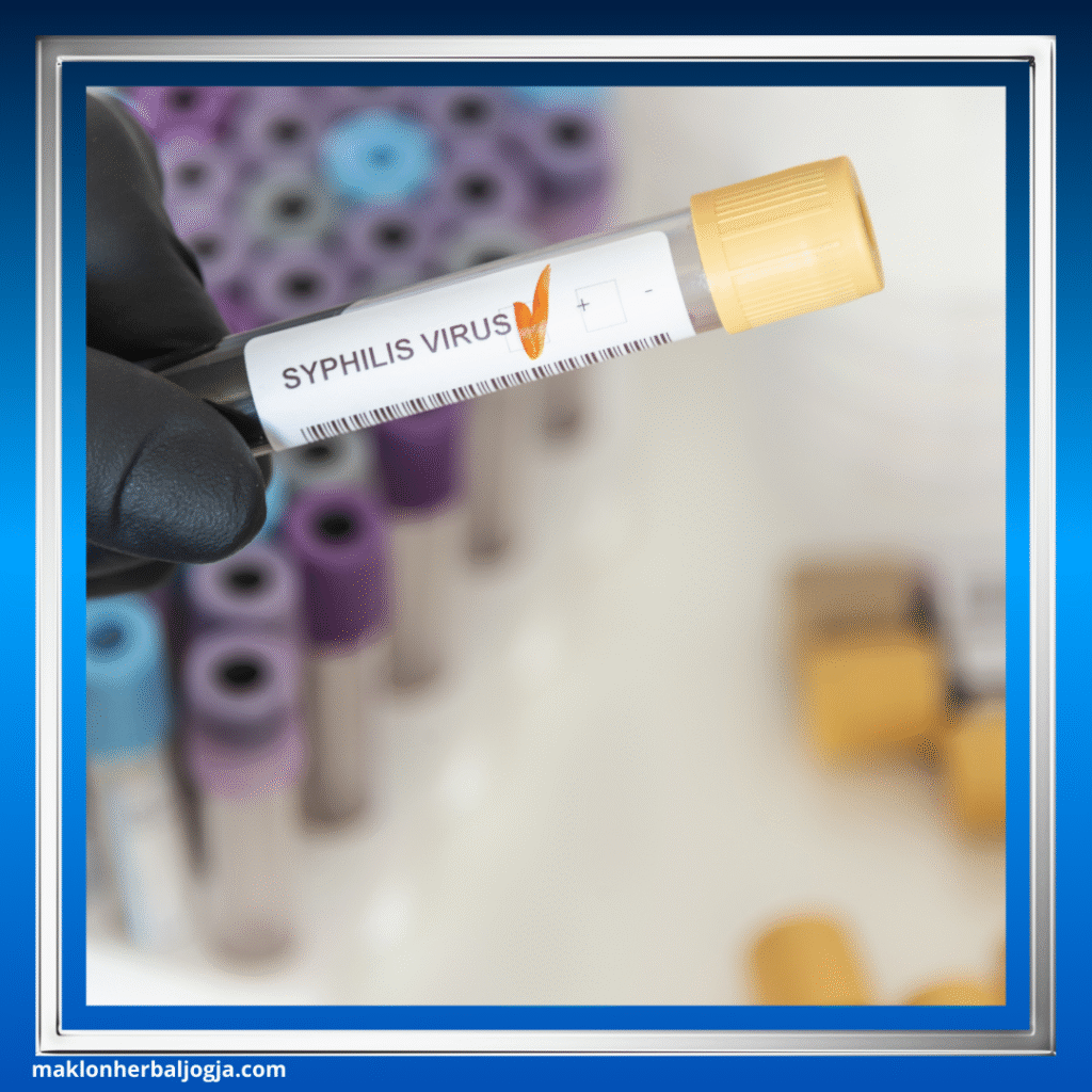 Sifilis pada Ibu Hamil
