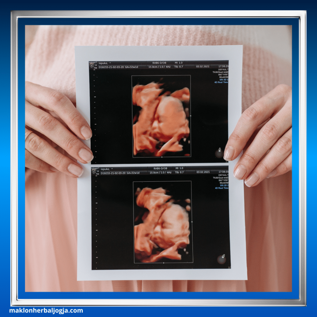 Sifilis pada Ibu Hamil