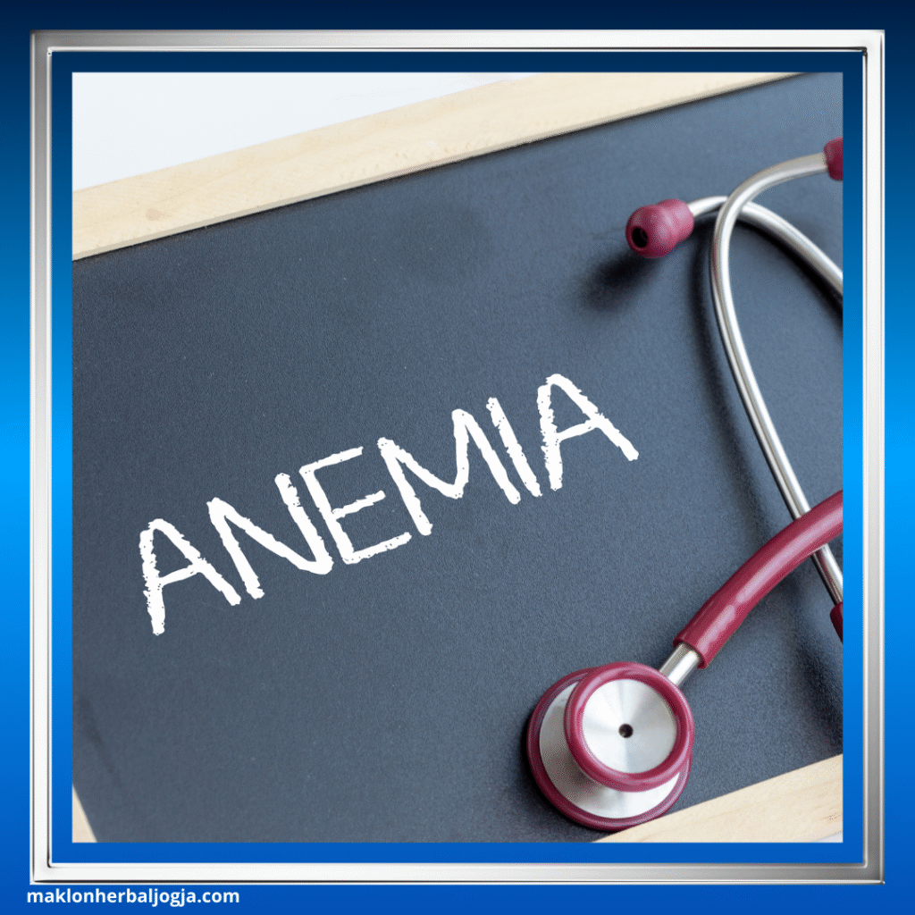 Gejala Anemia