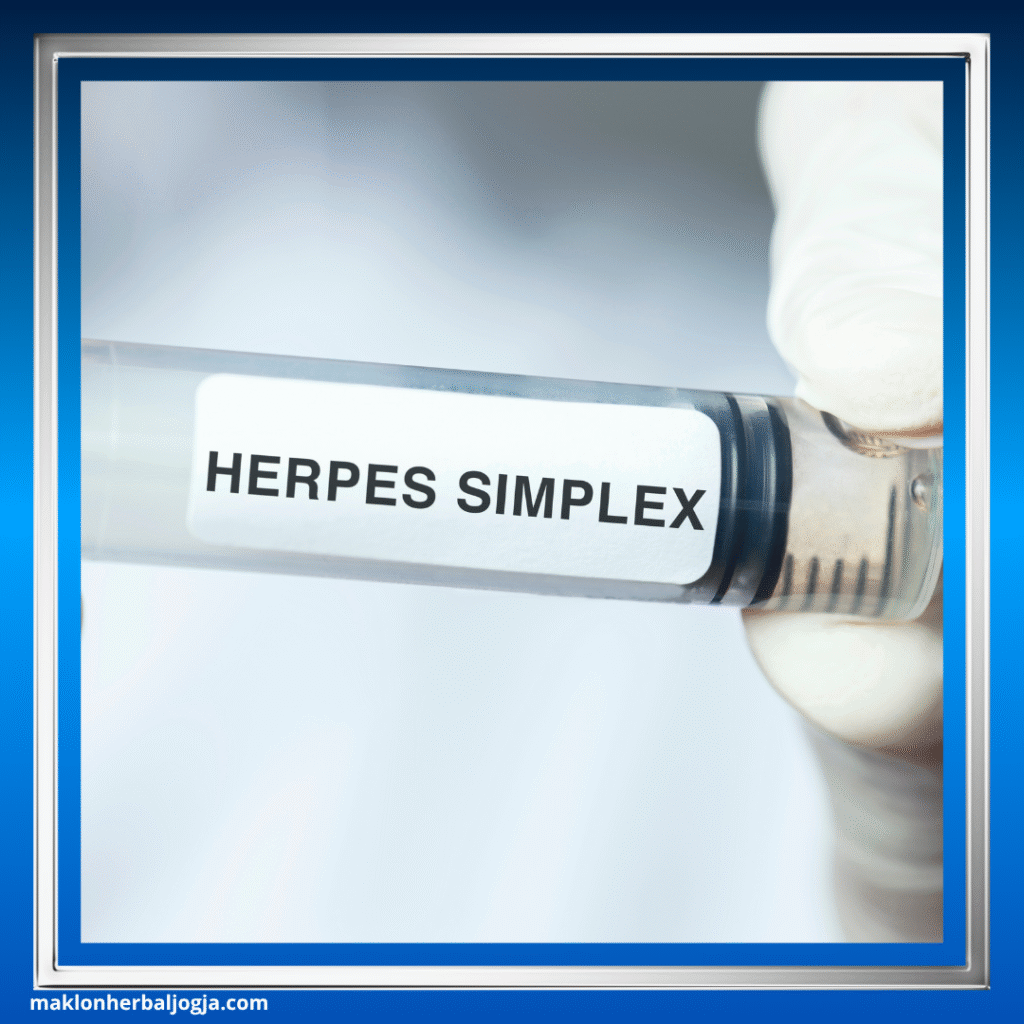 Penyakit Menular Seksual