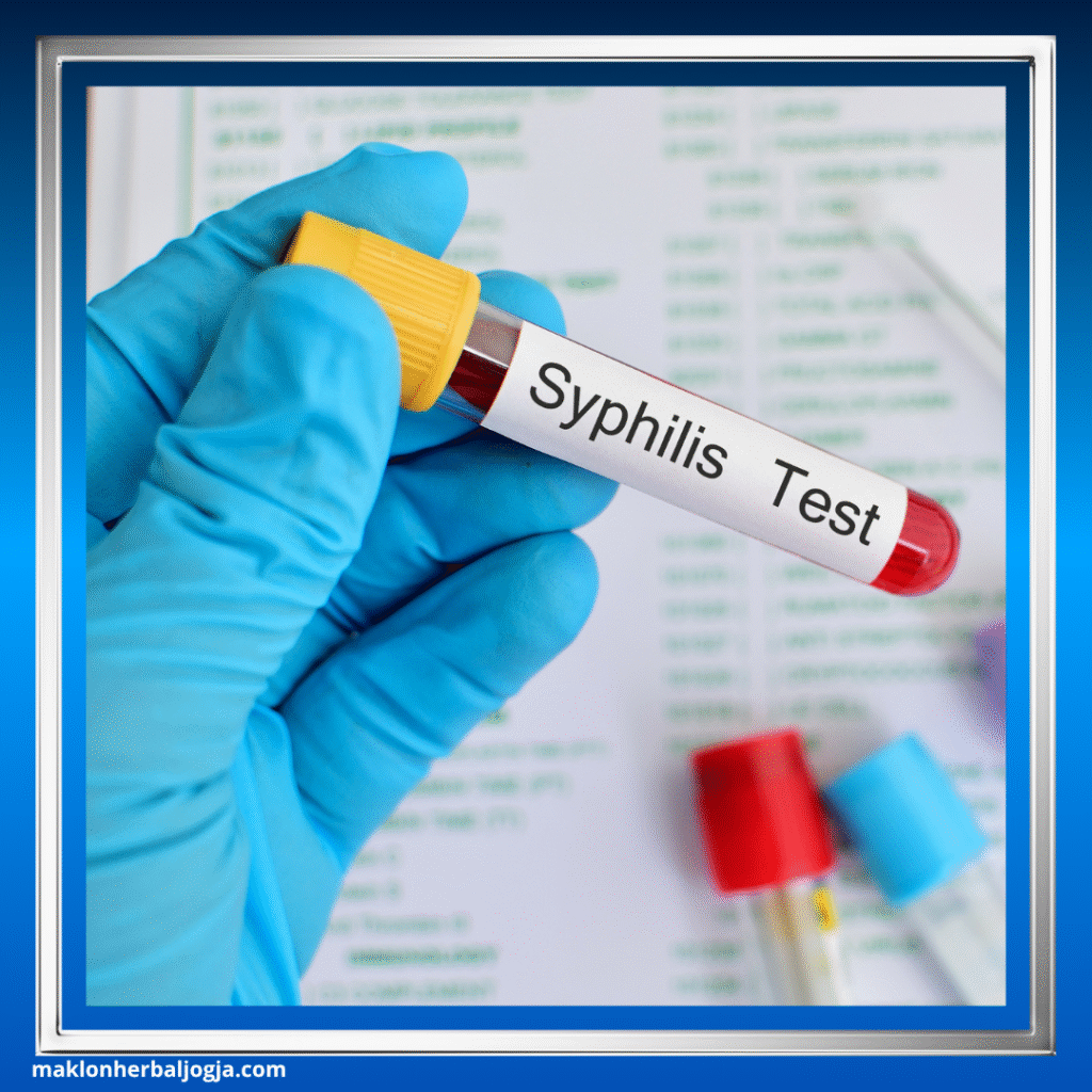 Penyakit Menular Seksual