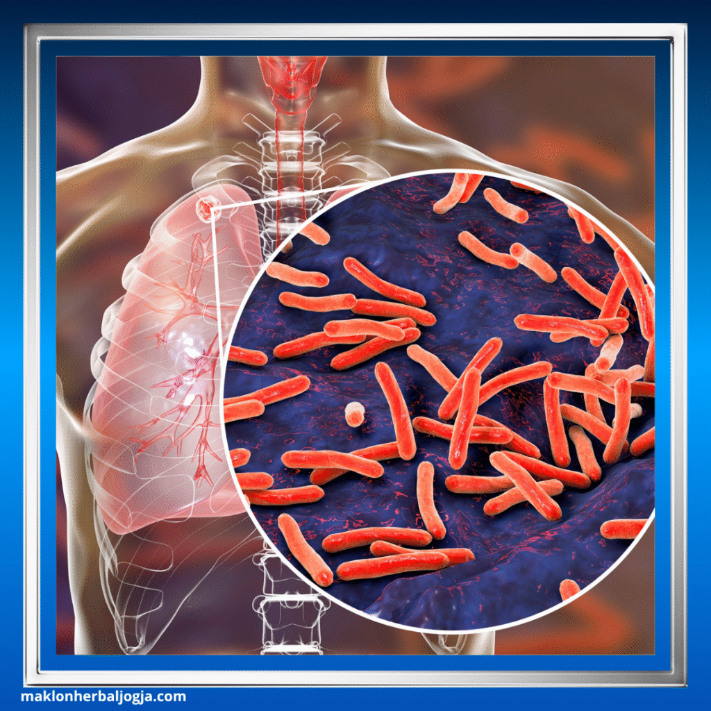 Jenis Penyakit Menular
