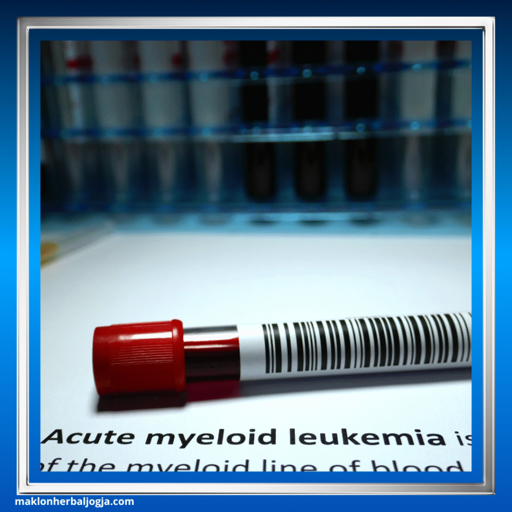 Tanda-Tanda Awal Leukemia