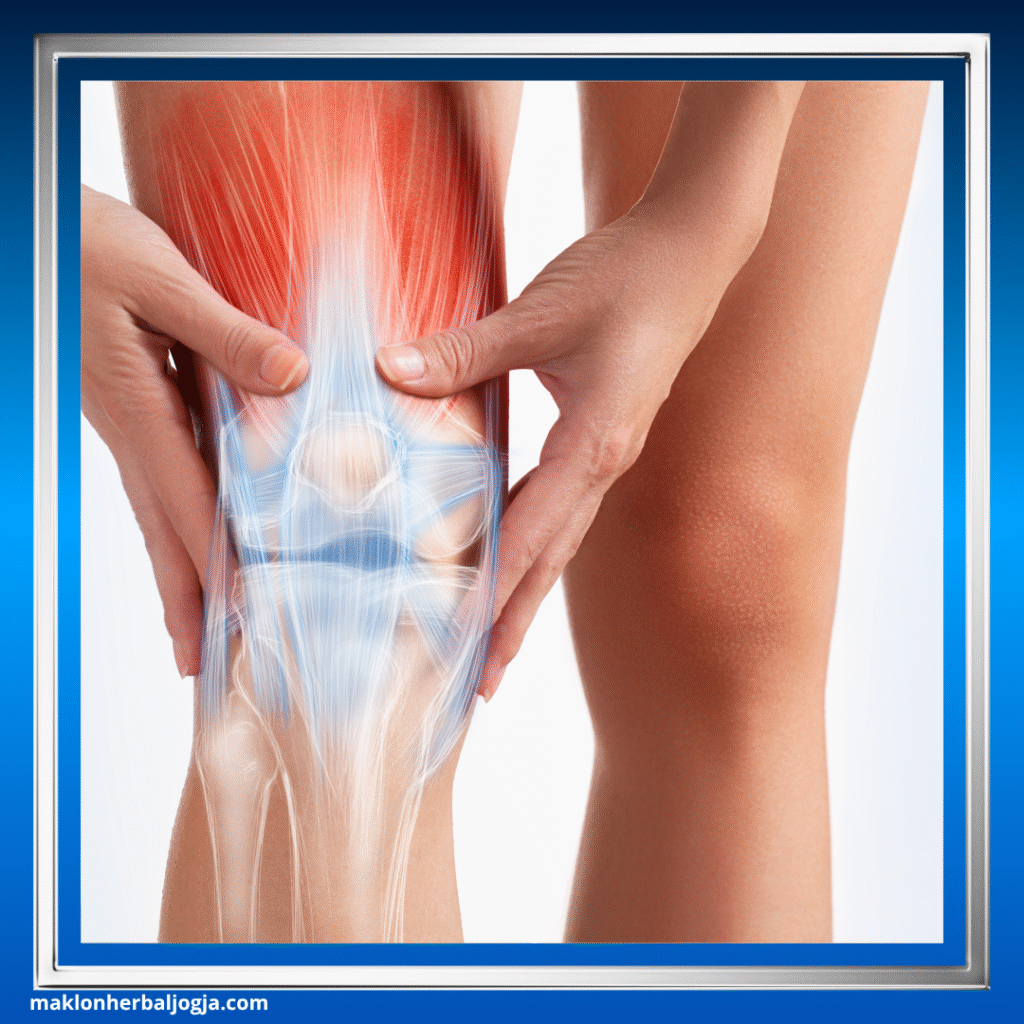 Herbal untuk Nyeri Sendi Lutut