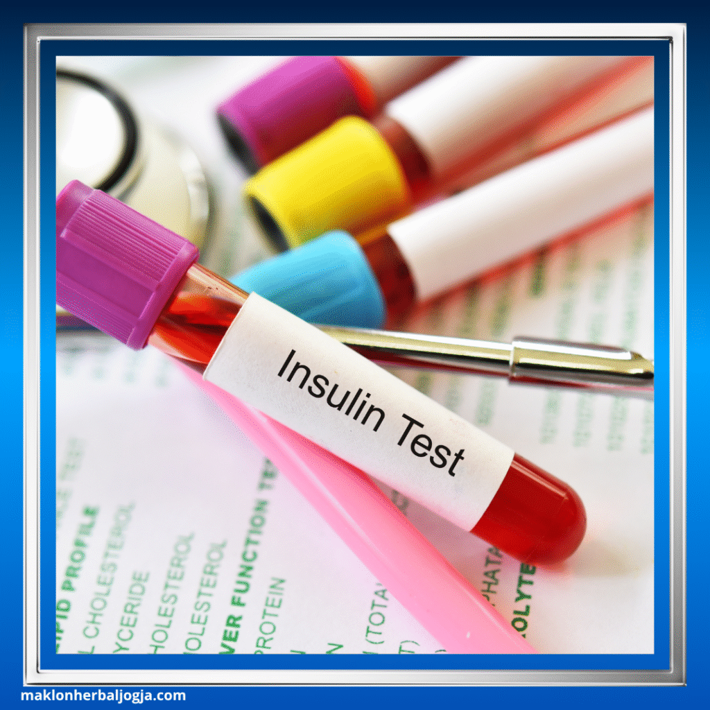 Cara Mengatasi Gula Kering 