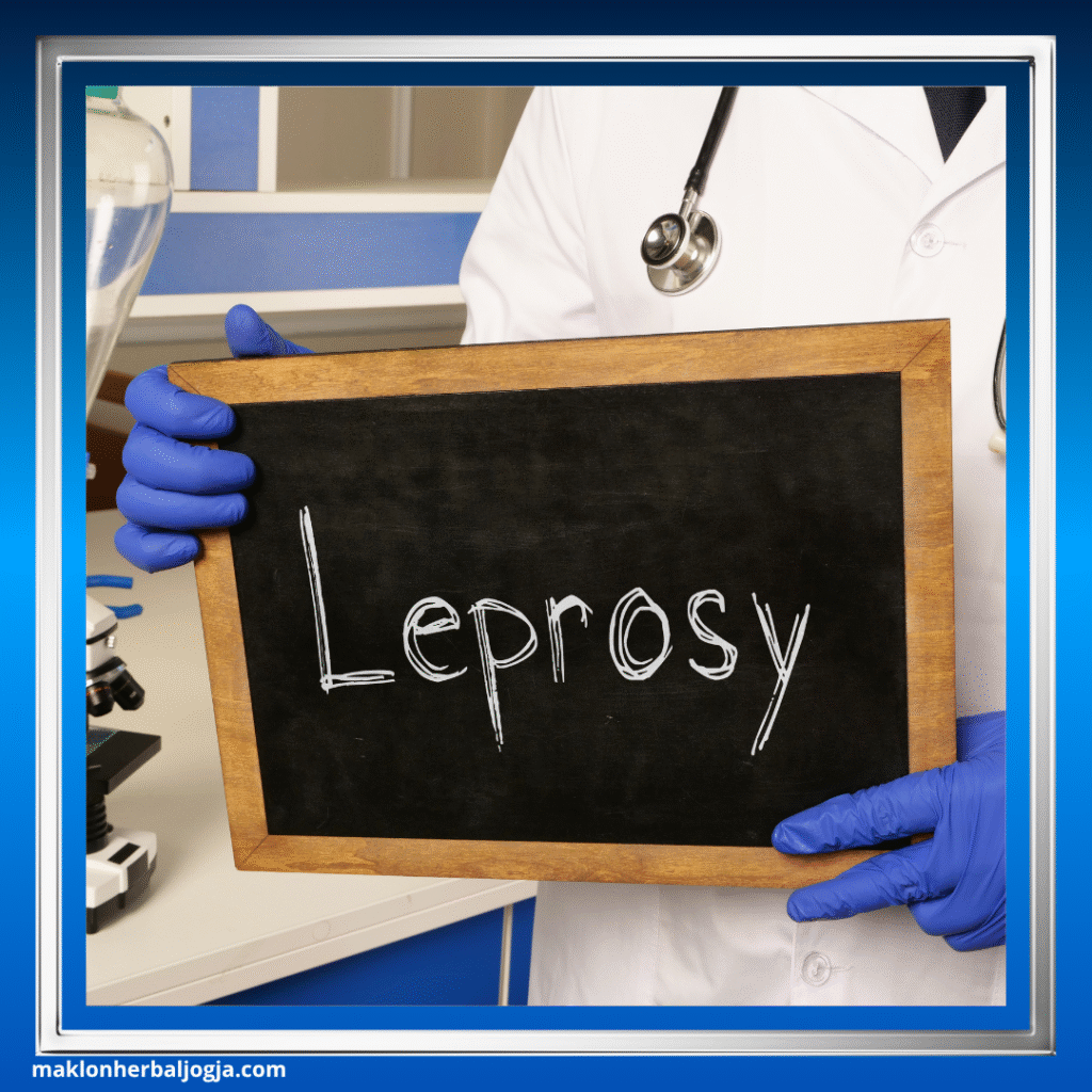 Penyakit Kusta