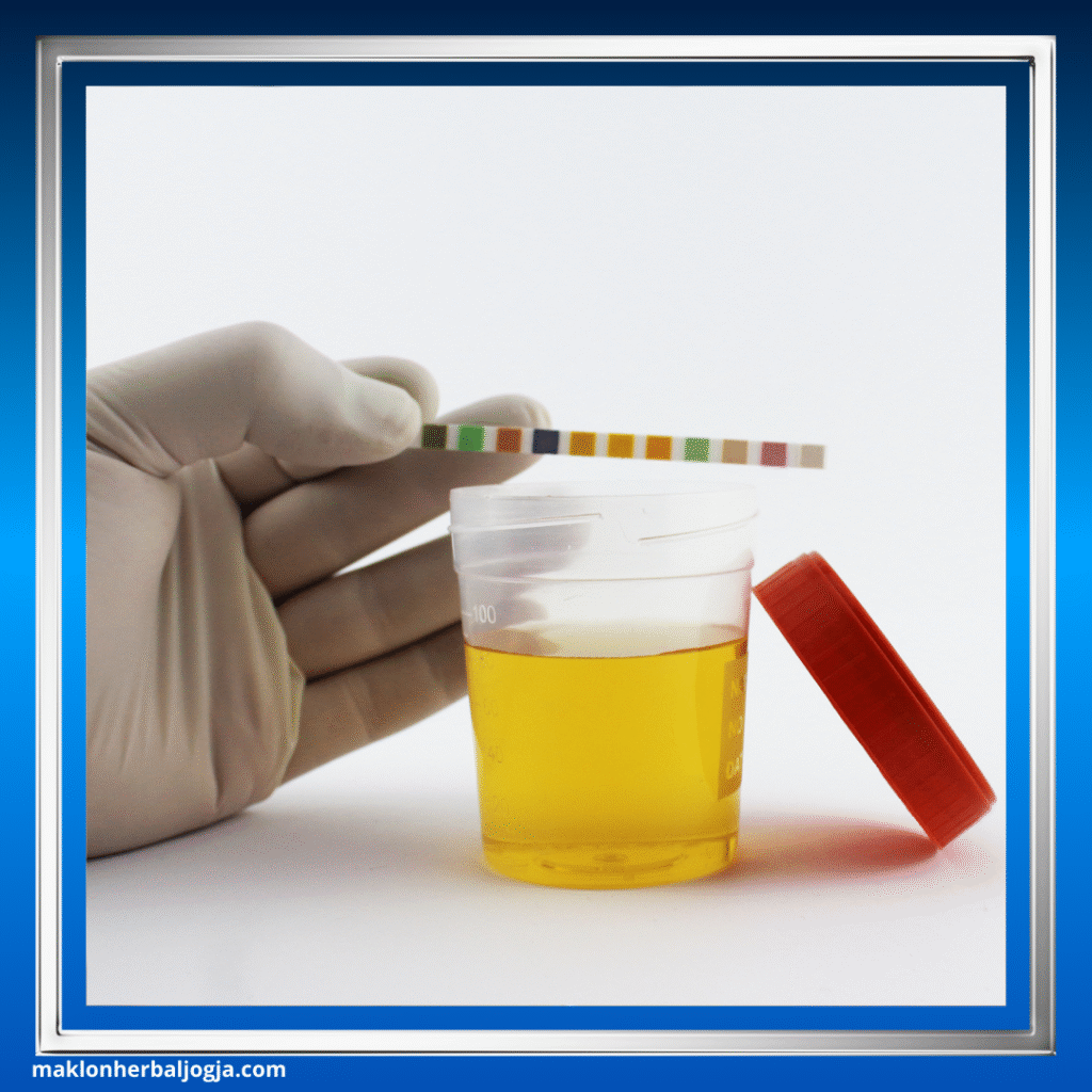 Ciri Penyakit Ginjal