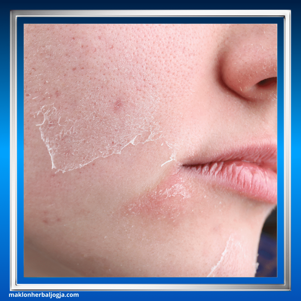 Ciri Penyakit Ginjal