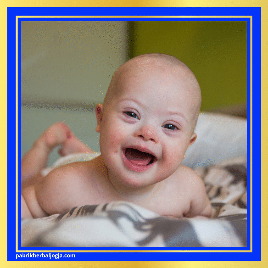 Penyebab Down Syndrome