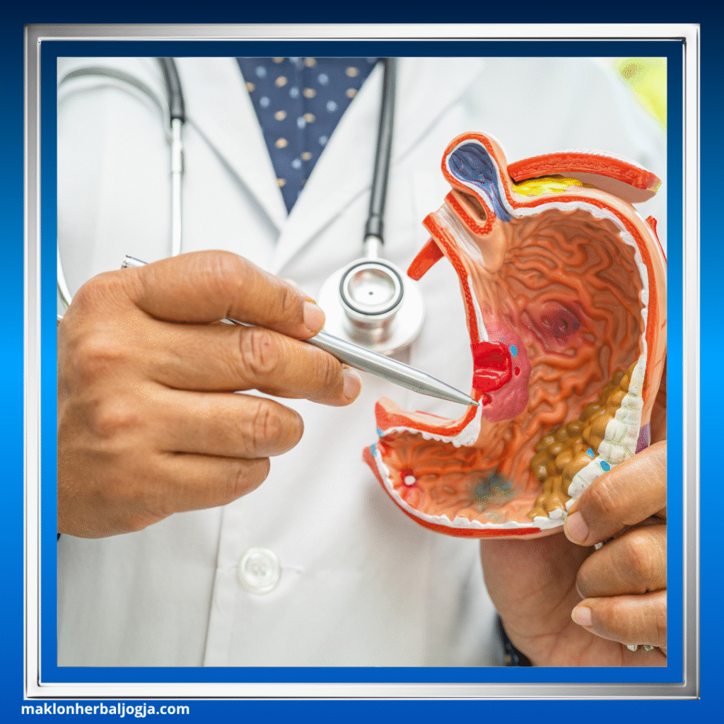 Penyebab Sakit di Ulu Hati